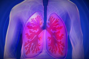 A tüdőrák elleni küzdelem összetett folyamat